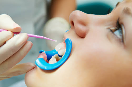 dental clinic at Mangalabag Cuttack xl dental care